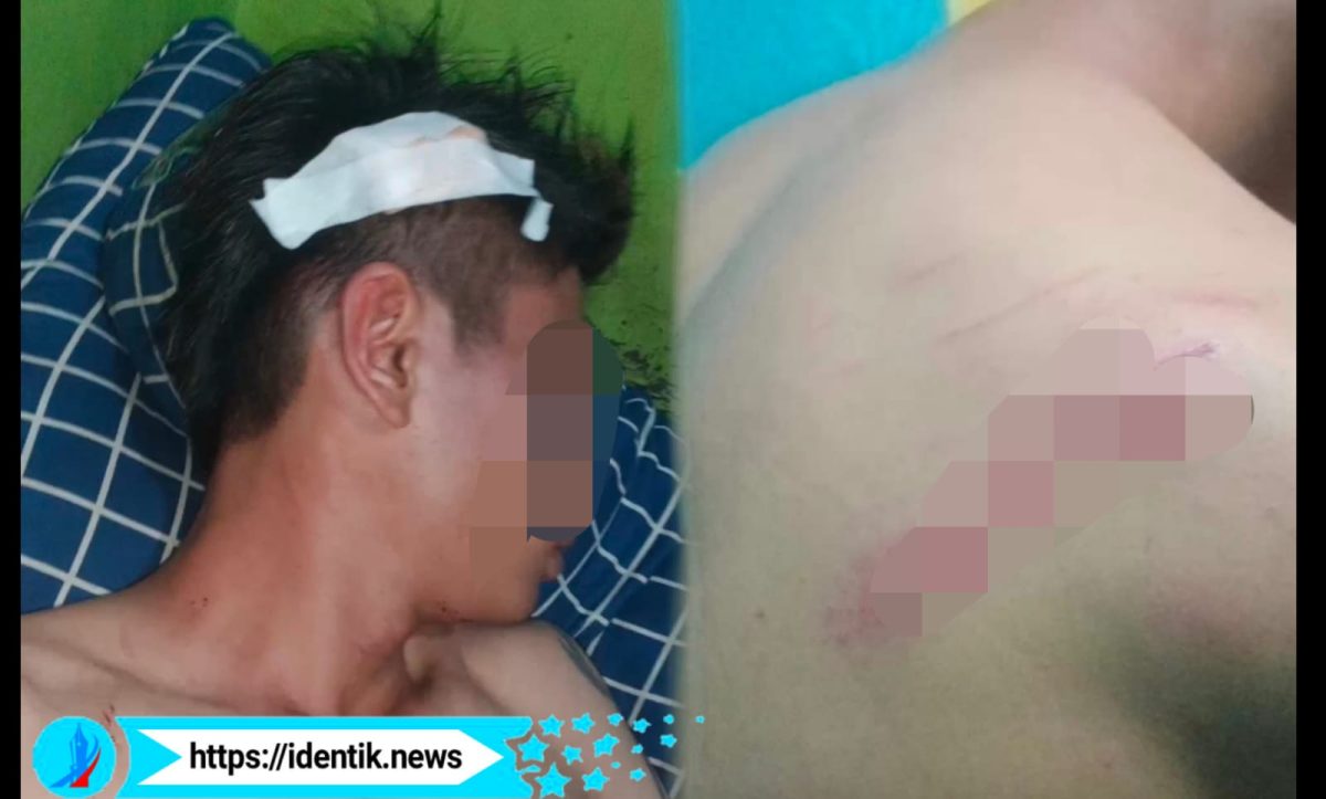 Frendly Sopir Taksi asal Bolmut Diduga Dianiaya Oknum Anggota Polisi